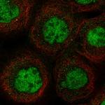 MSL1 Polyclonal Antibody