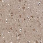 LLGL1 Antibody in Immunohistochemistry (Paraffin) (IHC (P))