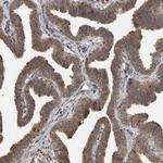 LLGL1 Antibody in Immunohistochemistry (Paraffin) (IHC (P))