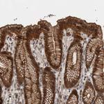 LLGL1 Antibody in Immunohistochemistry (Paraffin) (IHC (P))