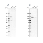 DDX42 Antibody in Western Blot (WB)