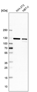 DDX42 Antibody in Western Blot (WB)