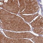 PHF21A Polyclonal Antibody