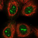 C17orf97 Polyclonal Antibody