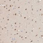 C17orf97 Antibody in Immunohistochemistry (Paraffin) (IHC (P))