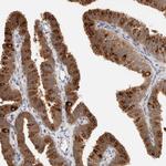 C17orf97 Antibody in Immunohistochemistry (Paraffin) (IHC (P))