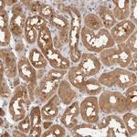 C17orf97 Antibody in Immunohistochemistry (Paraffin) (IHC (P))