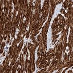 LONRF1 Antibody in Immunohistochemistry (Paraffin) (IHC (P))