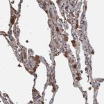 B3GNTL1 Antibody in Immunohistochemistry (Paraffin) (IHC (P))