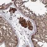 B3GNTL1 Antibody in Immunohistochemistry (Paraffin) (IHC (P))