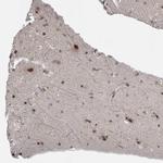 ZNF38 Antibody in Immunohistochemistry (Paraffin) (IHC (P))