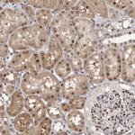 ZNF38 Antibody in Immunohistochemistry (Paraffin) (IHC (P))