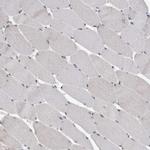 ZNF38 Antibody in Immunohistochemistry (Paraffin) (IHC (P))