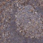 LRBA Polyclonal Antibody