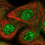 ZNF160 Polyclonal Antibody