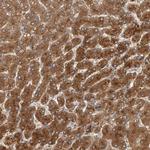 ZNF160 Antibody in Immunohistochemistry (Paraffin) (IHC (P))