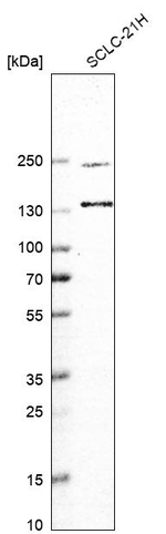 UBE2O Antibody in Western Blot (WB)