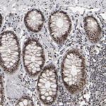 SURF6 Antibody in Immunohistochemistry (Paraffin) (IHC (P))