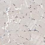 SURF6 Antibody in Immunohistochemistry (Paraffin) (IHC (P))