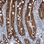 CDH17 Polyclonal Antibody