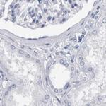 CDH17 Antibody in Immunohistochemistry (IHC)