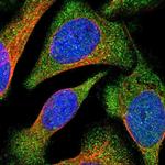 VPS9D1 Antibody in Immunocytochemistry (ICC/IF)