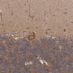 TRIM16 Antibody in Immunohistochemistry (Paraffin) (IHC (P))