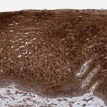 TRIM16 Polyclonal Antibody