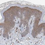 TRIM16 Antibody in Immunohistochemistry (Paraffin) (IHC (P))