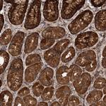 TRIM16 Antibody in Immunohistochemistry (Paraffin) (IHC (P))