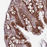 ITGB6 Antibody in Immunohistochemistry (Paraffin) (IHC (P))