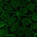 ITGB6 Polyclonal Antibody