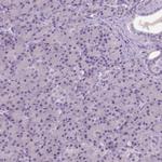 NECAB1 Antibody in Immunohistochemistry (Paraffin) (IHC (P))