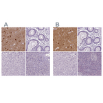 NECAB1 Antibody in Immunohistochemistry (Paraffin) (IHC (P))