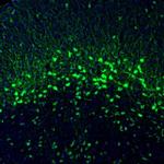 NECAB1 Antibody in Immunohistochemistry (Paraffin) (IHC (P))