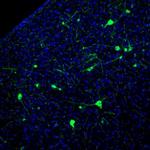 NECAB1 Antibody in Immunohistochemistry (Paraffin) (IHC (P))