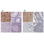 NECAB1 Antibody in Immunohistochemistry (IHC)