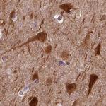 NECAB1 Antibody in Immunohistochemistry (IHC)