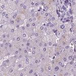 NECAB1 Antibody in Immunohistochemistry (IHC)