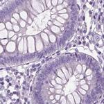 NECAB1 Antibody in Immunohistochemistry (IHC)