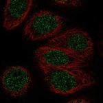 ZNF653 Polyclonal Antibody