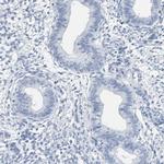 SPACA3 Polyclonal Antibody