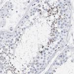 SPACA3 Antibody in Immunohistochemistry (Paraffin) (IHC (P))