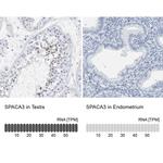 SPACA3 Antibody