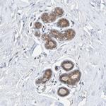 TATDN1 Polyclonal Antibody