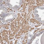 UNK Polyclonal Antibody