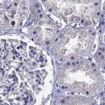 STAR Antibody in Immunohistochemistry (IHC)