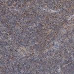 PROSC Polyclonal Antibody