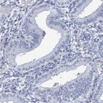 PROCA1 Antibody in Immunohistochemistry (Paraffin) (IHC (P))