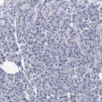 PROCA1 Antibody in Immunohistochemistry (Paraffin) (IHC (P))